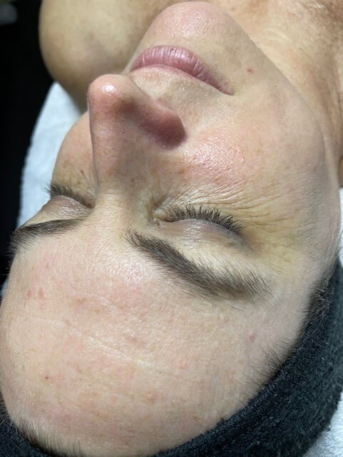 Before Image