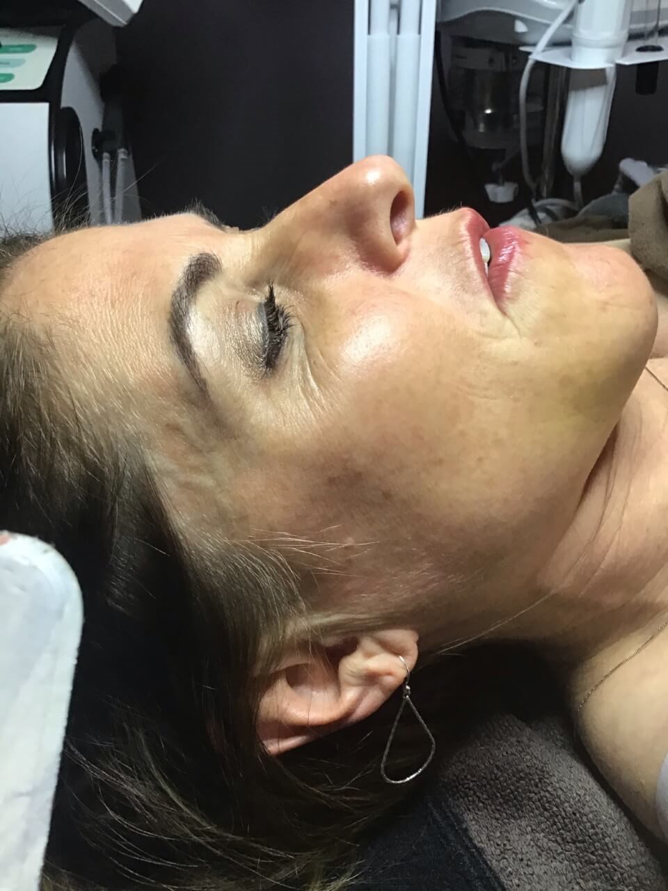 Before Image