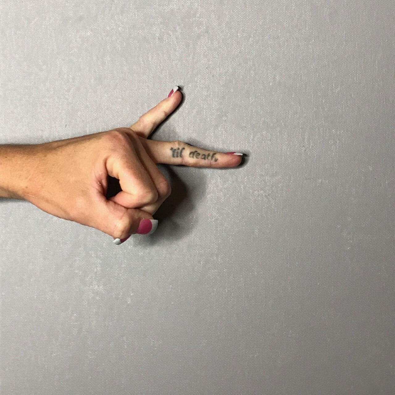 Tattoo Removal Post 3 Sessions Before