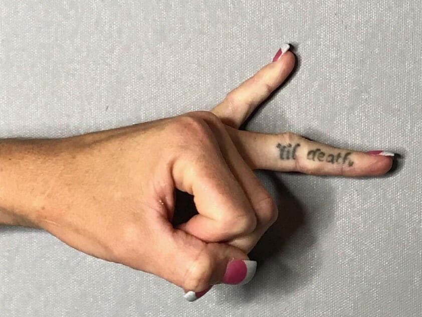 Tattoo Removal Post 3 Sessions Before