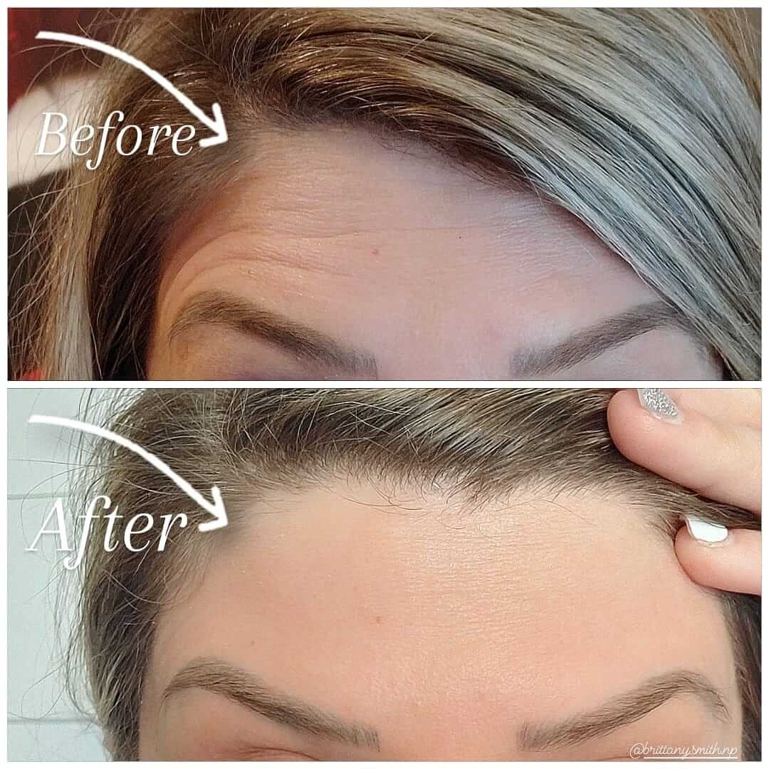 Before Image