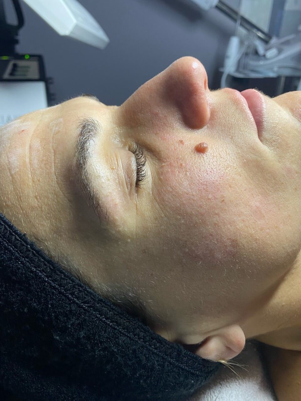 Before Image