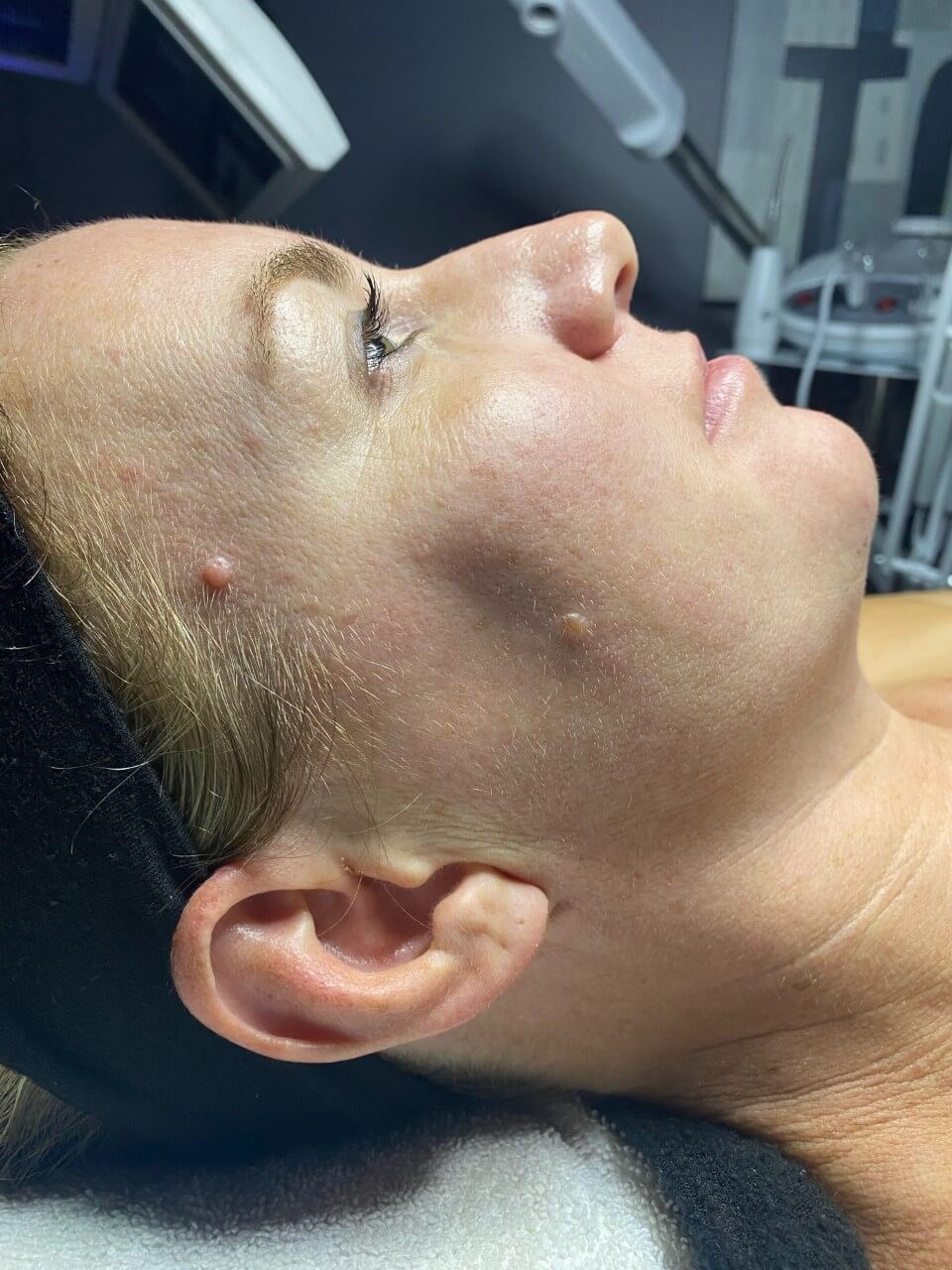 Before Image