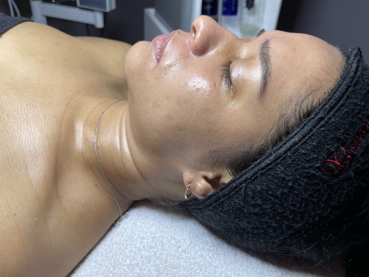 Diamond Glow and Dermaplaning After