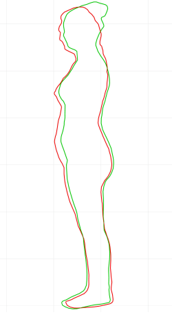 Styku 3D Body Imaging Outline