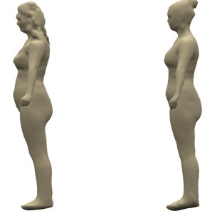 Styku 3D Body Imaging Side