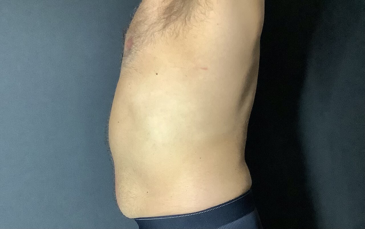 After Image
