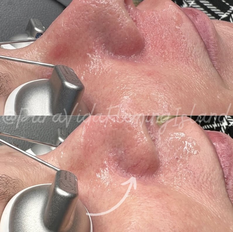 Before Image