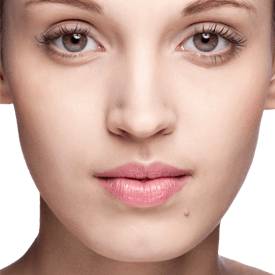 Dry Eye Disease - OptiLight