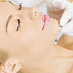 Chemical Peels